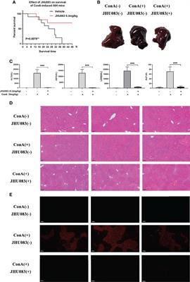 Targeting Glutamine Metabolism Ameliorates Autoimmune Hepatitis via Inhibiting T Cell Activation and Differentiation